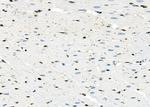 MYCNOS Antibody in Immunohistochemistry (Paraffin) (IHC (P))