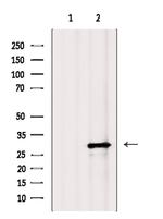 ALKBH2 Polyclonal Antibody