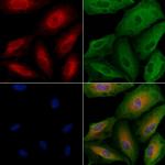 ALKBH7 Polyclonal Antibody