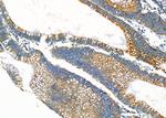 ALKBH7 Antibody in Immunohistochemistry (Paraffin) (IHC (P))