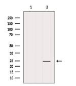 ALKBH7 Antibody in Western Blot (WB)
