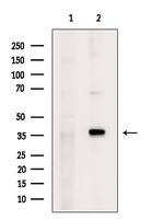 KLF16 Polyclonal Antibody