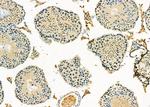 SP5 Antibody in Immunohistochemistry (Paraffin) (IHC (P))