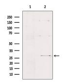 FMR1NB Antibody in Western Blot (WB)