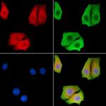 AGPAT1 Polyclonal Antibody