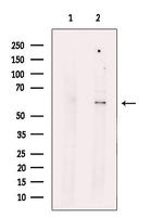 LPCAT4 Polyclonal Antibody