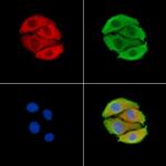 PSMD13 Polyclonal Antibody