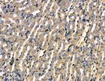 PSMD13 Antibody in Immunohistochemistry (Paraffin) (IHC (P))