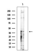 PSMD13 Antibody in Western Blot (WB)