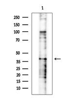 PSMD13 Antibody in Western Blot (WB)