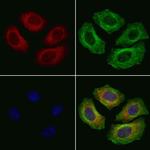 MRPS31 Polyclonal Antibody