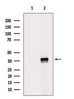 MRPL1 Polyclonal Antibody