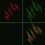 MRPL17 Polyclonal Antibody