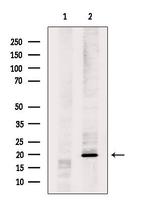 MRPL17 Antibody in Western Blot (WB)