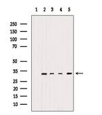 MRPL2 Polyclonal Antibody