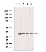 MRPL2 Antibody in Western Blot (WB)