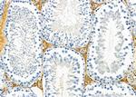 RM30 Antibody in Immunohistochemistry (Paraffin) (IHC (P))