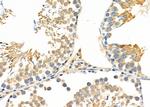 MRPL43 Antibody in Immunohistochemistry (Paraffin) (IHC (P))