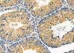 MRPL53 Antibody in Immunohistochemistry (Paraffin) (IHC (P))
