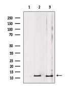 MRPL53 Antibody in Western Blot (WB)
