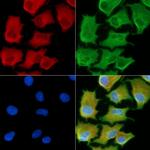 RPS15A Polyclonal Antibody