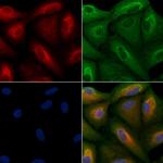 RPS21 Polyclonal Antibody