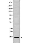 RPS26L1 Antibody in Western Blot (WB)