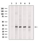 RPS3A Antibody in Western Blot (WB)