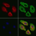 RPLP1 Polyclonal Antibody