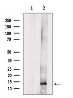 RPLP1 Antibody in Western Blot (WB)