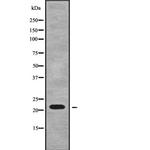 RPL18A Antibody in Western Blot (WB)