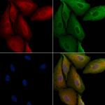 RPL29 Polyclonal Antibody