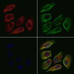 RPL35A Polyclonal Antibody