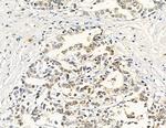 RPL36AL Antibody in Immunohistochemistry (Paraffin) (IHC (P))
