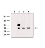 RPL36AL Antibody in Western Blot (WB)