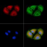 ABHD1 Polyclonal Antibody