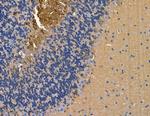 ABHD1 Antibody in Immunohistochemistry (Paraffin) (IHC (P))