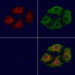 ABHD3 Polyclonal Antibody