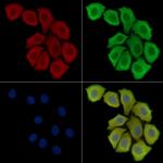 AWAT2 Polyclonal Antibody