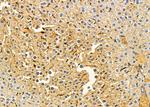 LPGAT1 Antibody in Immunohistochemistry (Paraffin) (IHC (P))