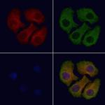 ACOX3 Polyclonal Antibody