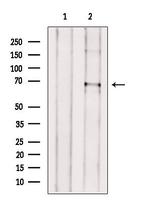 ACOT11 Polyclonal Antibody