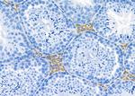 AOAH Antibody in Immunohistochemistry (Paraffin) (IHC (P))