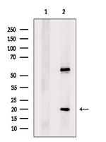 ACYP2 Polyclonal Antibody