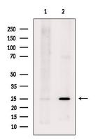 LYPLA2 Polyclonal Antibody