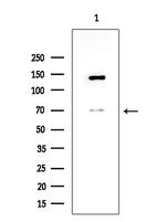 ADAM23 Polyclonal Antibody