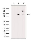 ADAM28 Polyclonal Antibody
