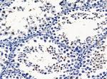 ADAM30 Polyclonal Antibody
