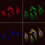 AGXT2 Polyclonal Antibody