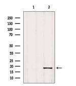 RPP25L Antibody in Western Blot (WB)